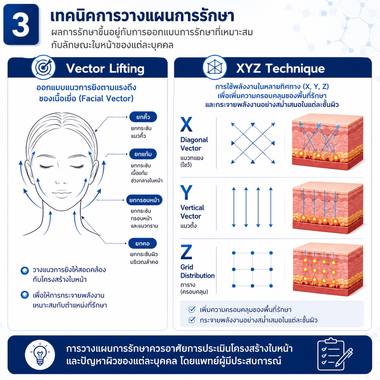 เทคนิคการยกกระชับใบหน้าและคิ้วด้วย Triple-Lined Multifocused Ultrasound: โปรแกรม X-Triple เทคนิคการยกกระชับใบหน้าและคิ้วด้วย Triple-Lined Multifocused Ultrasound: โปรแกรม X-Triple