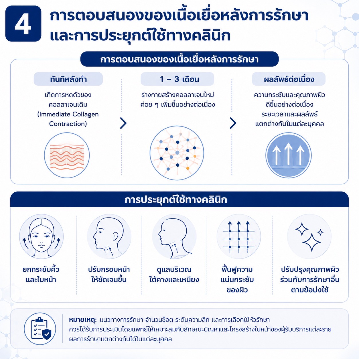 เทคนิคการยกกระชับใบหน้าและคิ้วด้วย Triple-Lined Multifocused Ultrasound: โปรแกรม X-Triple