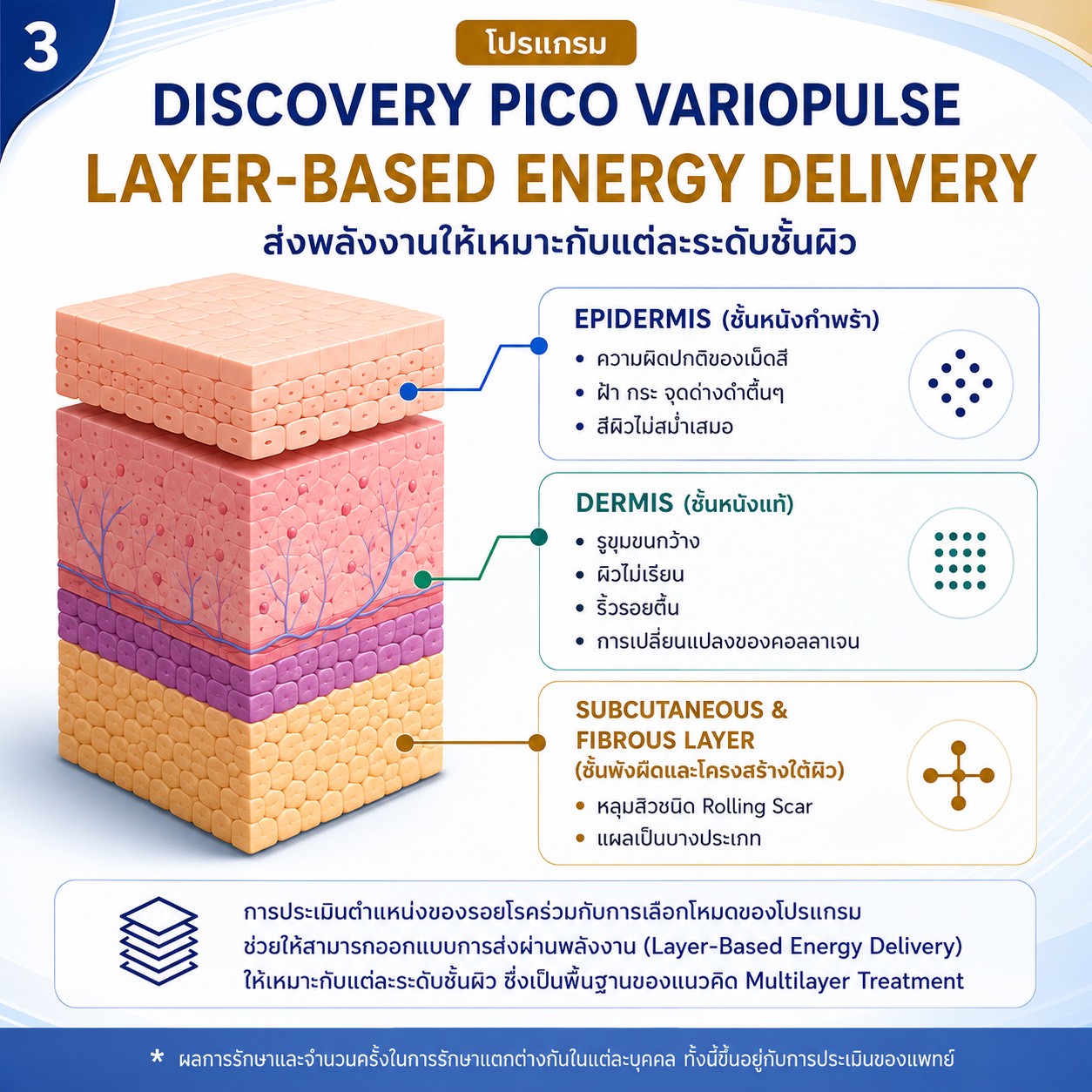 โปรแกรม Multimodality & Multilayer Discovery Pico VarioPulse Treatment