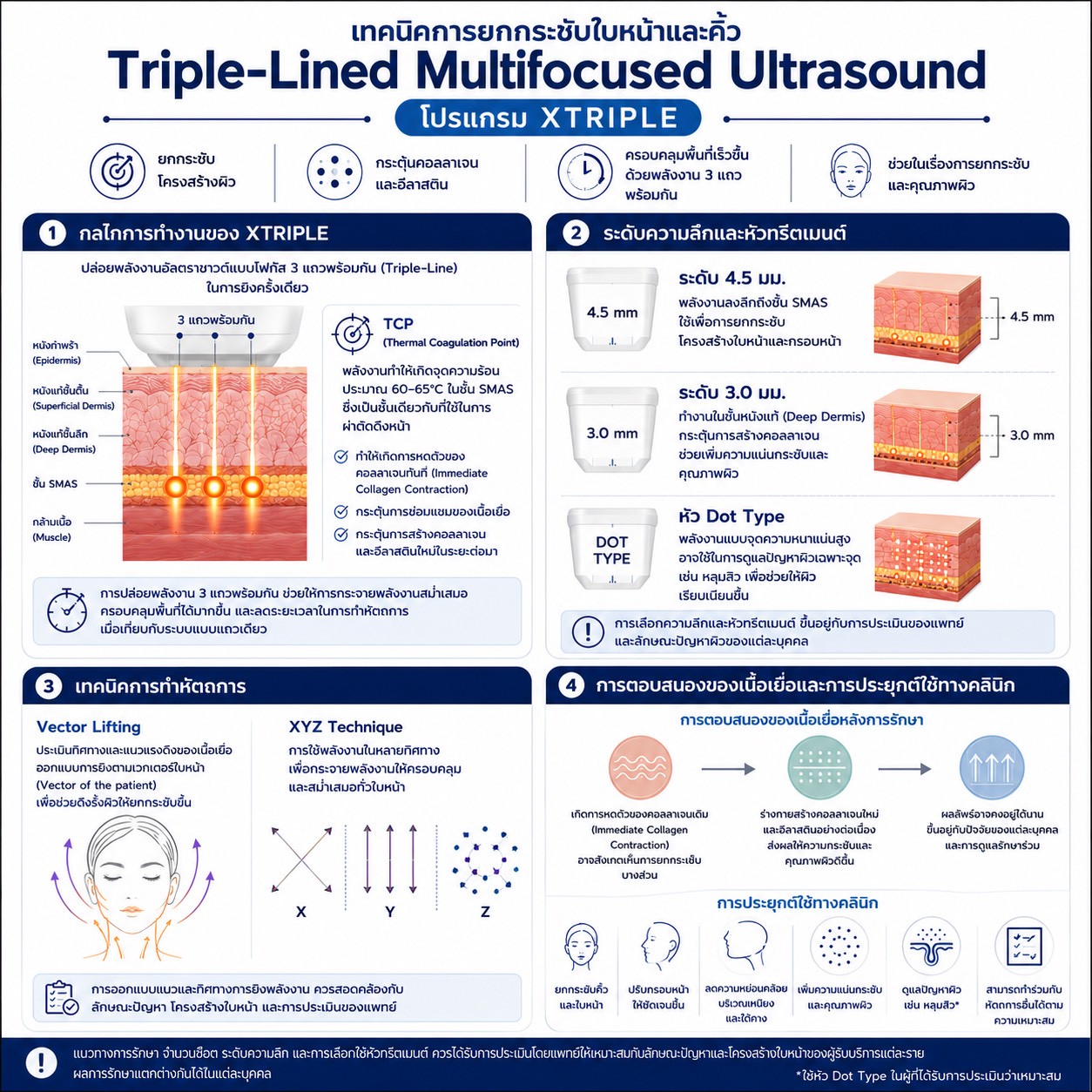 เทคนิคการยกกระชับใบหน้าและคิ้วด้วย Triple-Lined Multifocused Ultrasound: โปรแกรม X-Triple เทคนิคการยกกระชับใบหน้าและคิ้วด้วย Triple-Lined Multifocused Ultrasound: โปรแกรม X-Triple
