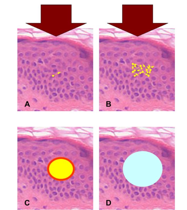 ตัวอย่างการรักษาหลุมสิว ปัญหาเม็ดสีด้วย Multimodality & Multilayer Program Discovery Pico VarioPulse