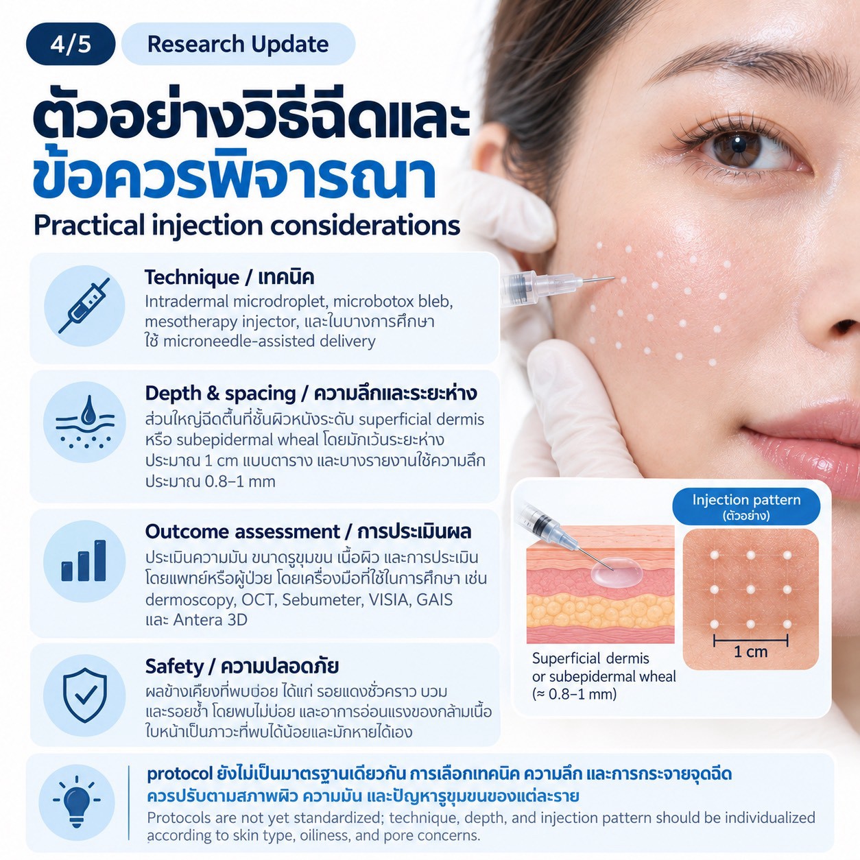 งานวิจัยทบทวน: การฉีด Botulinum Toxin Type A ในชั้นผิวเพื่อช่วยลดความมันและรูขุมขนกว้าง