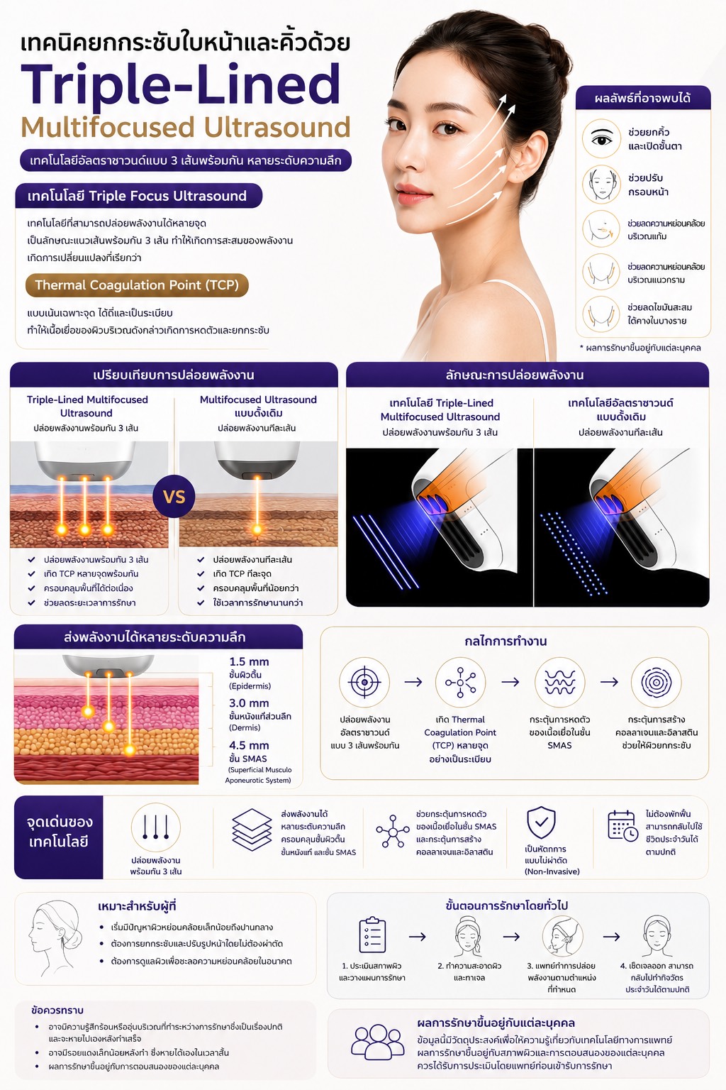 เทคนิค ยกกระชับใบหน้าและคิ้วด้วย เทคนิค Triple-Lined Multifocused Ultrasound
