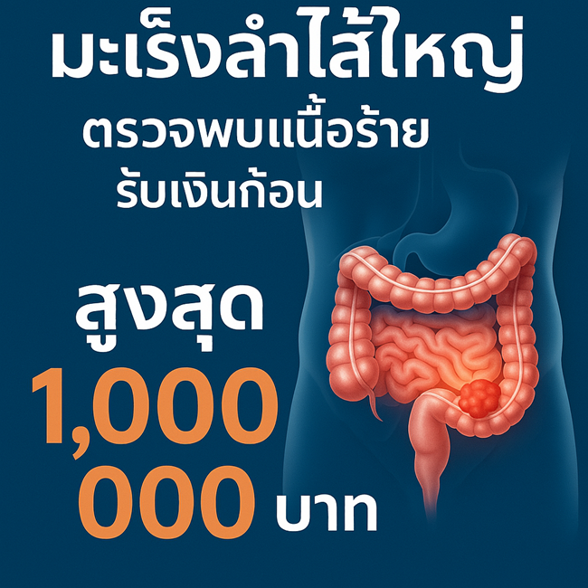 มะเร็งลำไส้ใหญ่ ตรวจพบเนื้อร้าย รับเงินก้อน สูงสุด 1,000,000 บาท