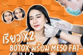 หน้าเรียวเป๊ะมุมไหนก็รอดเลือก Botox + Meso Fat