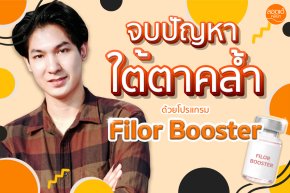 ใต้ตาดำจนโดนทักว่าเหมือน... หมีแพนด้า