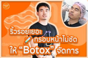 ริ้วรอยเยอะ กรอบหน้าไม่ชัด จัดโปรแกรม Botox ไปเลยสิครับบ