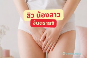 สิวที่น้องสาว เกิดจากอะไร? อันตรายไหม ควรบีบเองหรือไม่