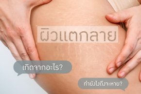 ผิวแตกลาย เกิดจากอะไร??