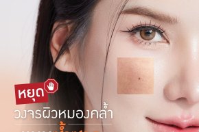 หยุดวงจรผิวหมองคล้ำแบบซ้ำซาก