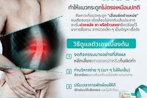 "กระดูกสันหลังเคลื่อน" สัญญาณเตือนที่ห้ามมองข้าม