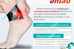 เอ็นร้อยหวายอักเสบ คืออะไร ️