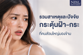 รวมสาเหตุเเละปัจจัยกระตุ้นฝ้า - กระ ที่คนส่วนใหญ่มองข้าม