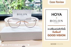 Case Review | EP.19 จะเปลี่ยนแว่นอีกกี่ครั้ง ก็เปลี่ยนที่ Good Vision