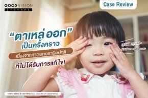 Case Study | EP.02 ตาเหล่ ออกเป็นครั้งคราว ภาวะสายตาผิดปกติที่ไม่ได้รับการแก้ไข