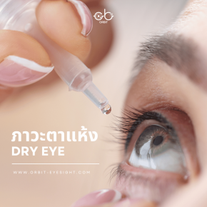 ภาวะตาแห้ง (Dry eye) 