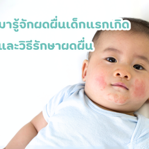 ผดผื่นคันในเด็ก ผื่นผ้าอ้อม