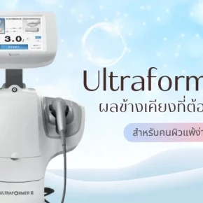 Ultraformer III มีผลข้างเคียงอะไรบ้างที่ต้องระวัง สำหรับคนผิวแพ้ง่าย