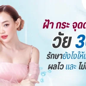 รักษาฝ้ากระ