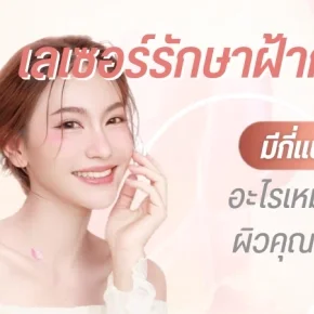 เลเซอร์ ฝ้า กระ