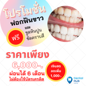 โปรโมชั่น ฟอกฟันขาว ขัดคราบสี ขูดหินปูน จัดเต็ม ผ่อนได้ 1,000- 6 เดือน