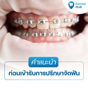 คำแนะนำก่อนเข้ารับการปรึกษาจัดฟัน