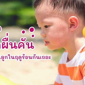 เตรียมรับมือผดผื่นคัน จากเหงื่อของคุณลูกในฤดูร้อนกันเถอะ