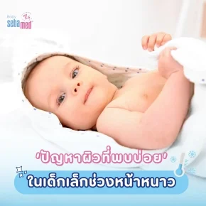 ปัญหาผิวที่พบบ่อยในเด็กเล็กช่วงหน้าหนาว