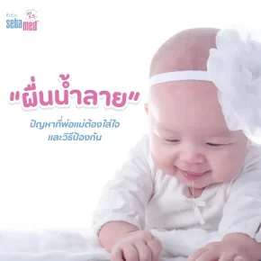 กลากน้ำลาย