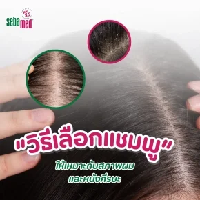 วิธีเลือกแชมพู