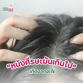 หนังศีรษะมันเกินไป_เกิดจากอะไร
