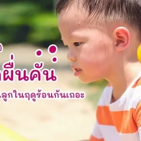 เตรียมรับมือผดผื่นคัน จากเหงื่อของคุณลูกในฤดูร้อน