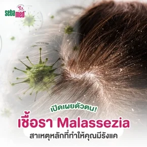 เปิดเผยตัวตน_เชื้อรา_Malassezia