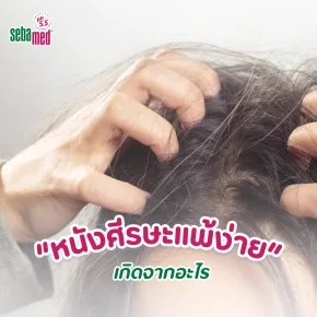 หนังศีรษพแพ้ง่ายเกดจากอะไร