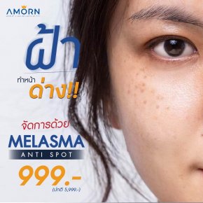 Melasma Anti Spot (รักษาฝ้า)