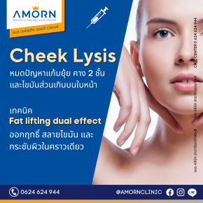 Cheek Lysis | สลายเหนี่ยง แก้มยุ้ย