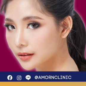 ฟิลเลอร์ FILLER | เติมเต็มร่องลึก ปรับรูปหน้า