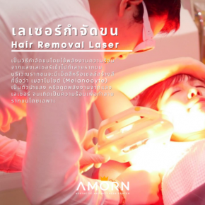 LASER HAIR REMOVAL | เลเซอร์กำจัดขน