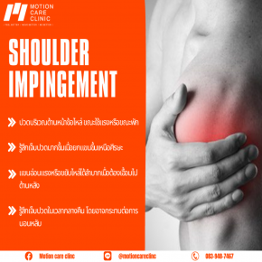 โรค Shoulder Impingement Syndrome ปวดไหล่ ยกแขนแล้วปวด