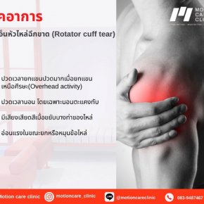 เช็คลิสอาการ เอ็นหัวไหล่ฉีกขาด (Rotator cuff tear)