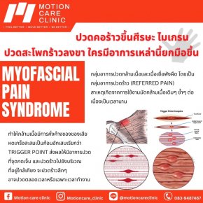 Myofascial pain syndrome 