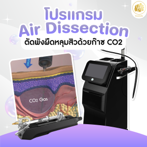 โปรแกรม Air Dissection รักษาหลุมสิวด้วยก๊าซ CO2 คืออะไร?