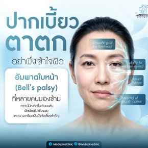 ปากเบี้ยว ตาตก อย่าเพิ่งเข้าใจผิด! รู้จักโรคอัมพาตใบหน้า (Bell's palsy) และวิธีรักษา