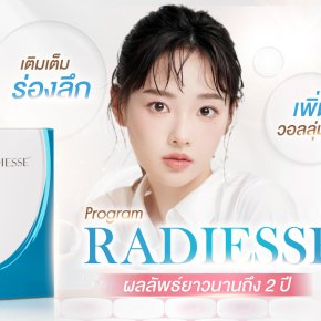 Radiesse นวัตกรรมที่ช่วยฟื้นฟูผิวแบบองค์รวม