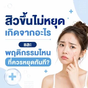 สิวขึ้นไม่หยุด_เกิดจากอะไร