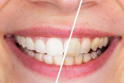 ทันตกรรมเพื่อความงามใหม่และปรับปรุงใหม่