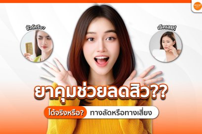 แก้ปัญหาสิวด้วยยาคุม ทางลัดหรือทางเสี่ยง?