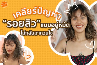 เบื่อไหมกับผิวหน้าหมองคล้ำ รอยสิวที่ฝังลึก