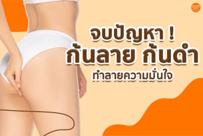 ก้นลาย ก้นดำ เกิดจากสาเหตุใด  แก้ปัญหาได้อย่างไร ?