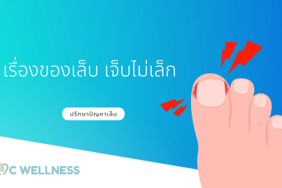 ตรวจและรักษาเล็บเชื้อรา และเล็บขบ | CMC Wellness